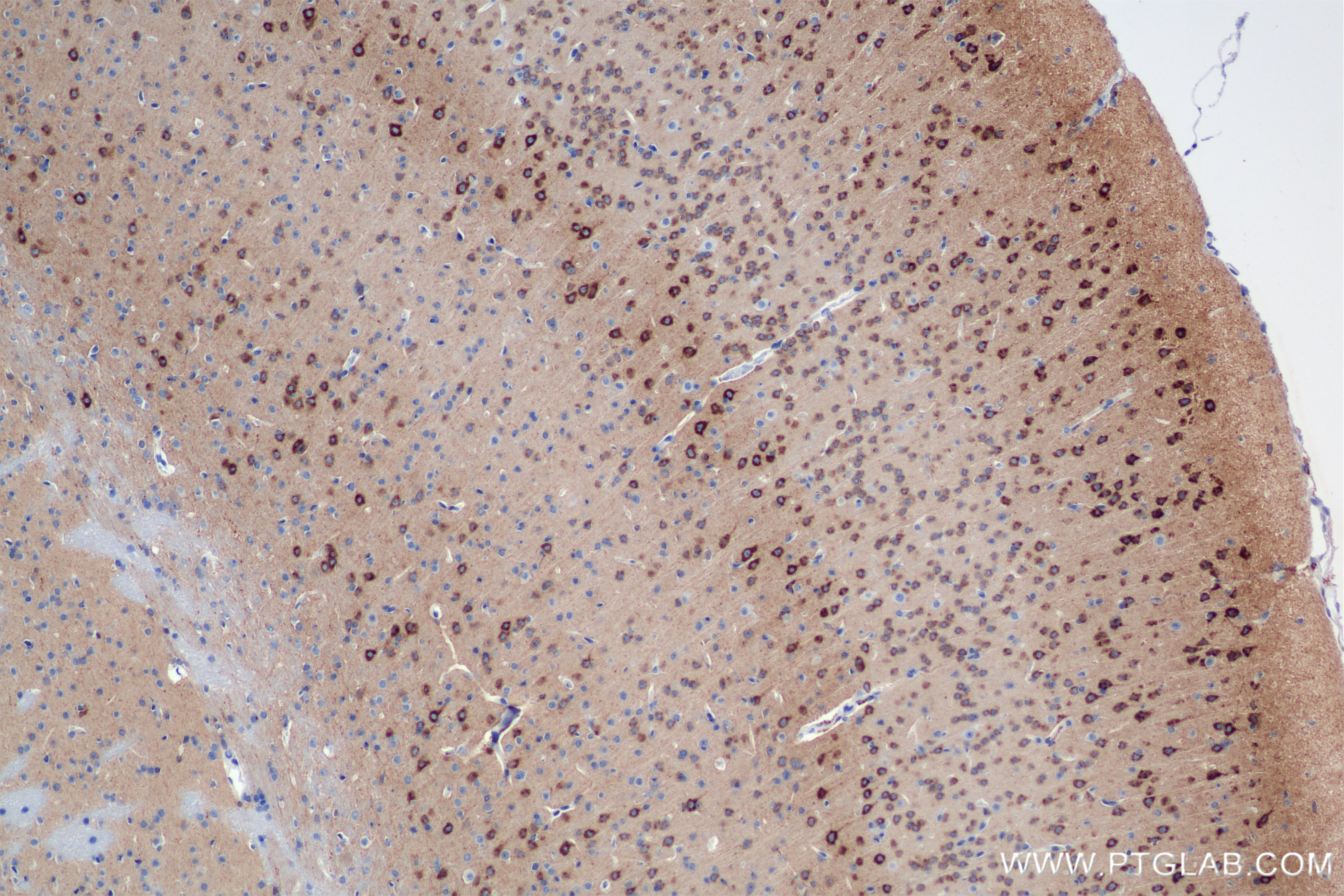 Immunohistochemistry (IHC) staining of mouse brain tissue using NPTXR Recombinant antibody (85994-1-RR)
