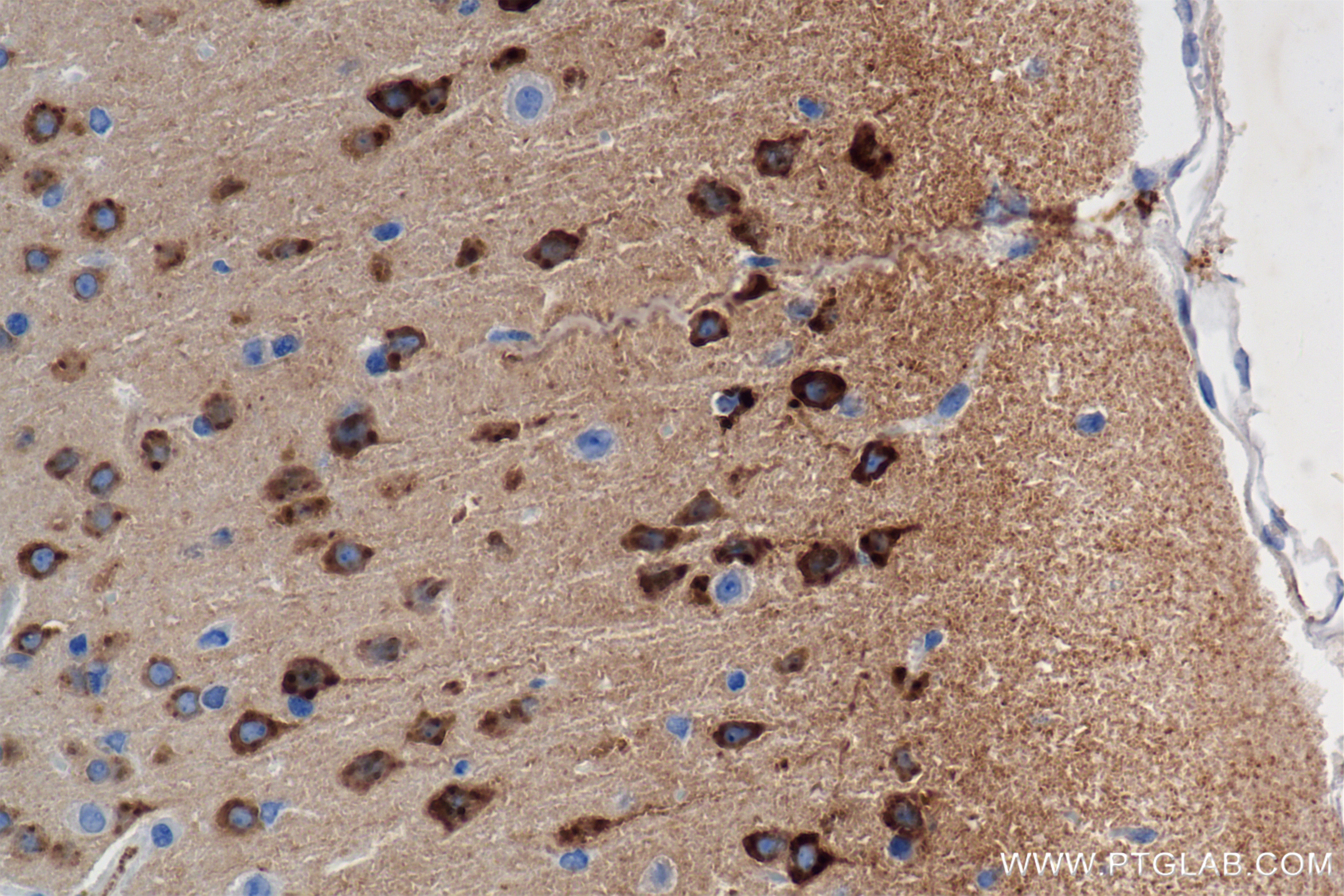 Immunohistochemistry (IHC) staining of mouse brain tissue using NPTXR Recombinant antibody (85994-1-RR)