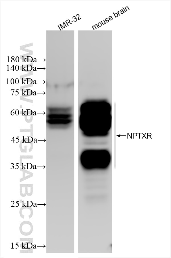 Western Blot (WB) analysis of various lysates using NPTXR Recombinant antibody (85994-1-RR)