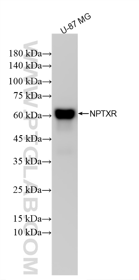 Western Blot (WB) analysis of various lysates using NPTXR Recombinant monoclonal antibody (85994-1-RR)