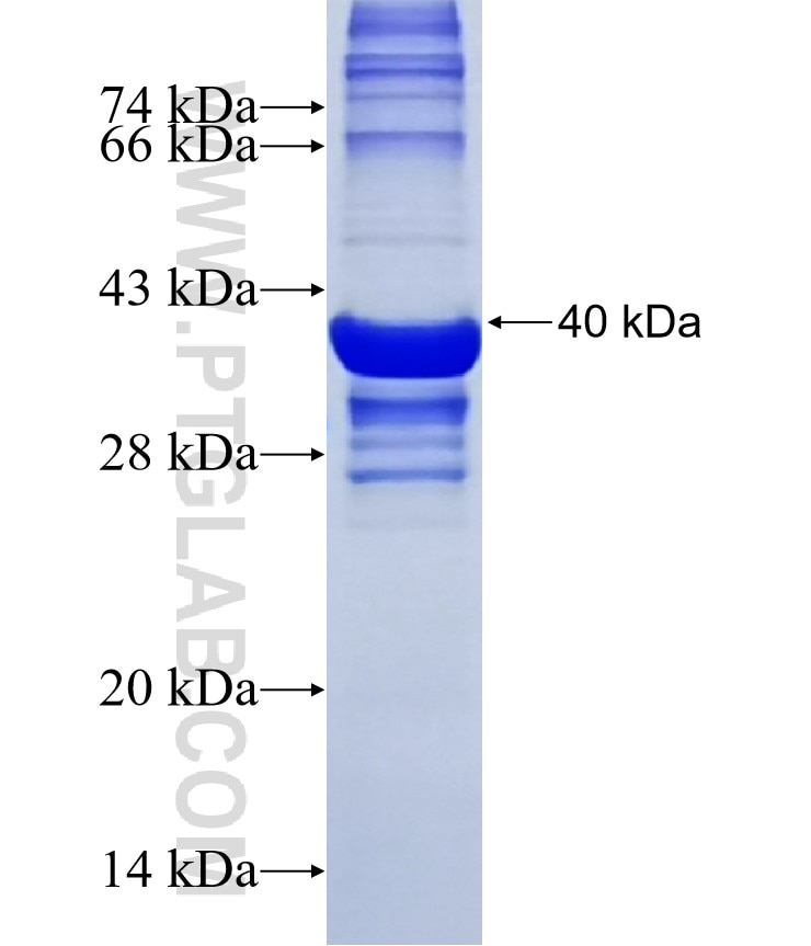 NPTXR fusion protein Ag20185 SDS-PAGE