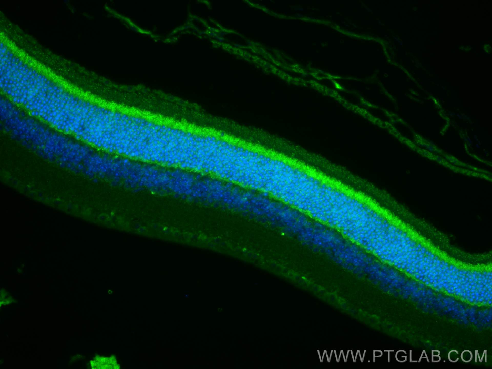 Immunofluorescence (IF) / fluorescent staining of mouse eye tissue using Neuropeptide Y Polyclonal antibody (12833-1-AP)
