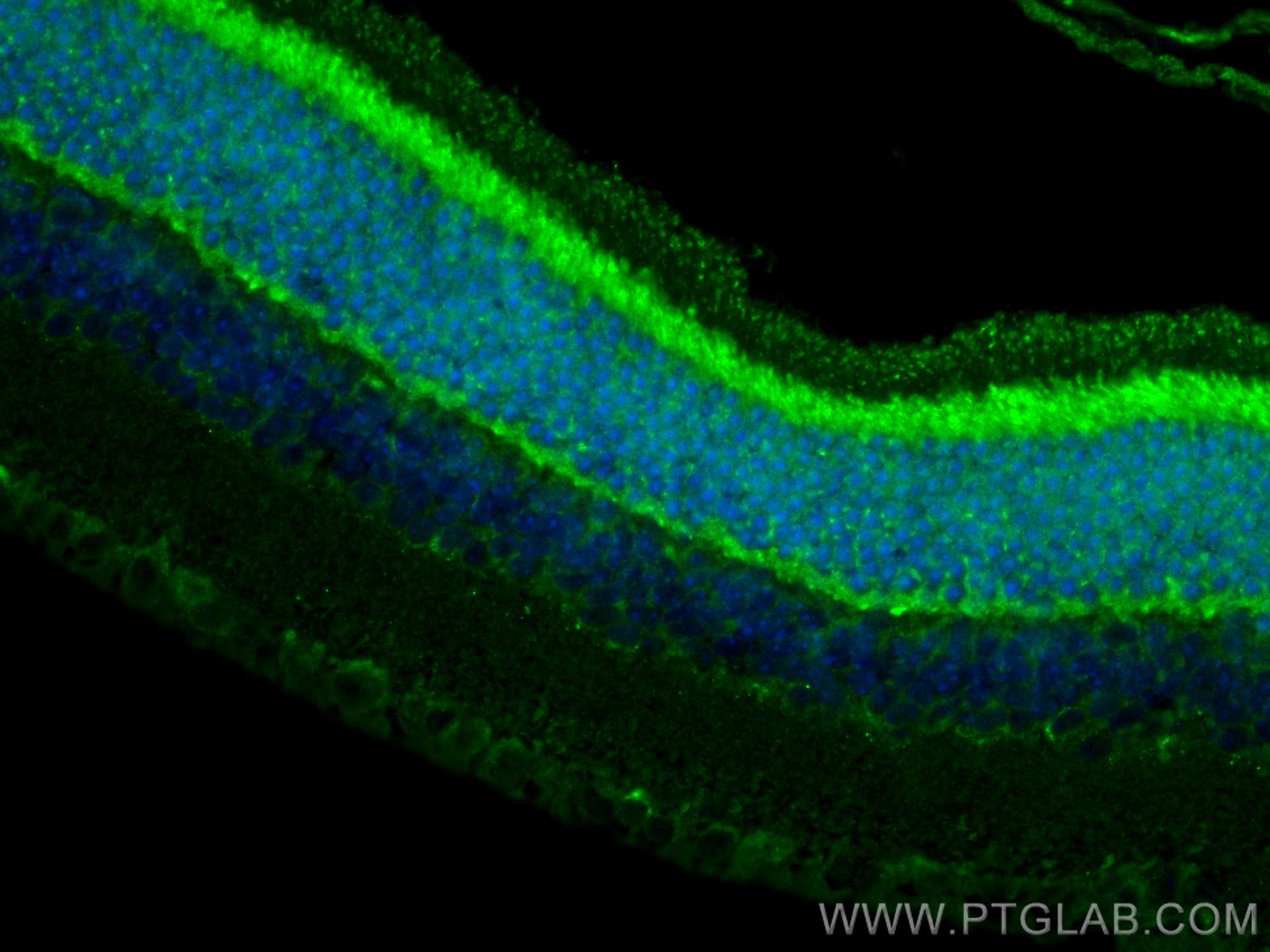 Immunofluorescence (IF) / fluorescent staining of mouse eye tissue using Neuropeptide Y Polyclonal antibody (12833-1-AP)