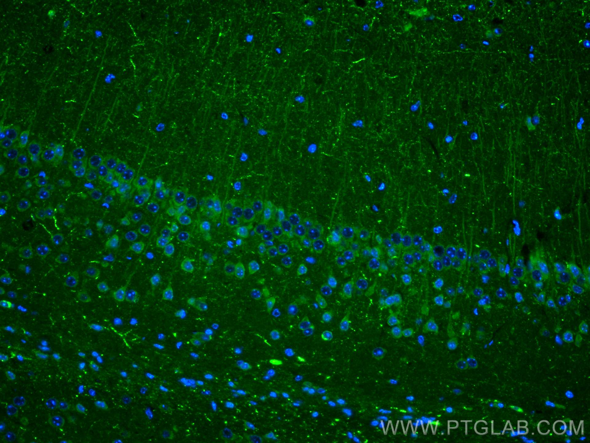 Immunofluorescence (IF) / fluorescent staining of mouse brain tissue using Neuropeptide Y Polyclonal antibody (12833-1-AP)