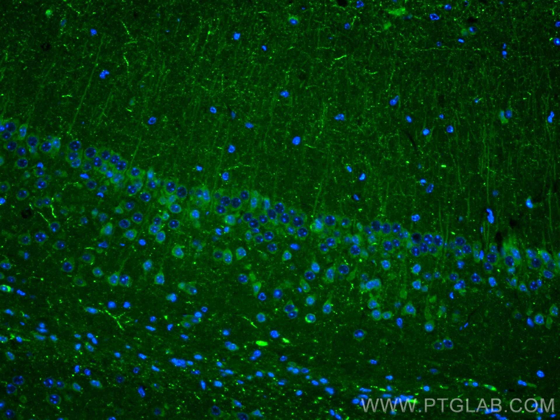 Immunofluorescence (IF) / fluorescent staining of mouse brain tissue using Neuropeptide Y Polyclonal antibody (12833-1-AP)