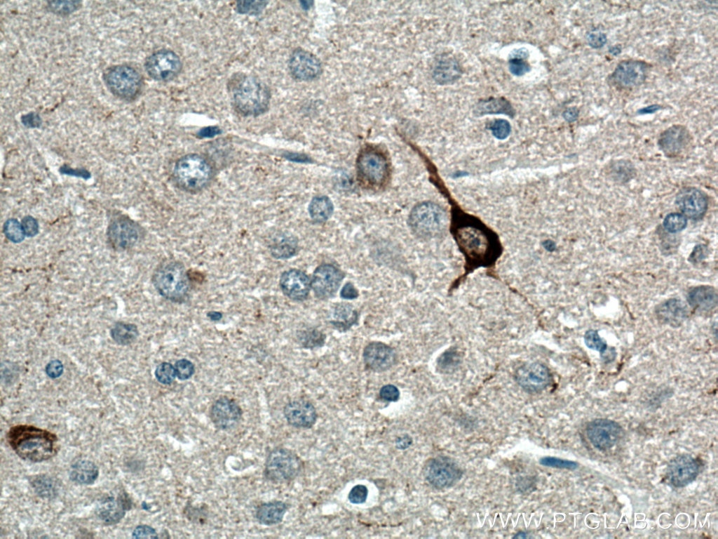 Immunohistochemistry (IHC) staining of rat brain tissue using Neuropeptide Y Polyclonal antibody (12833-1-AP)