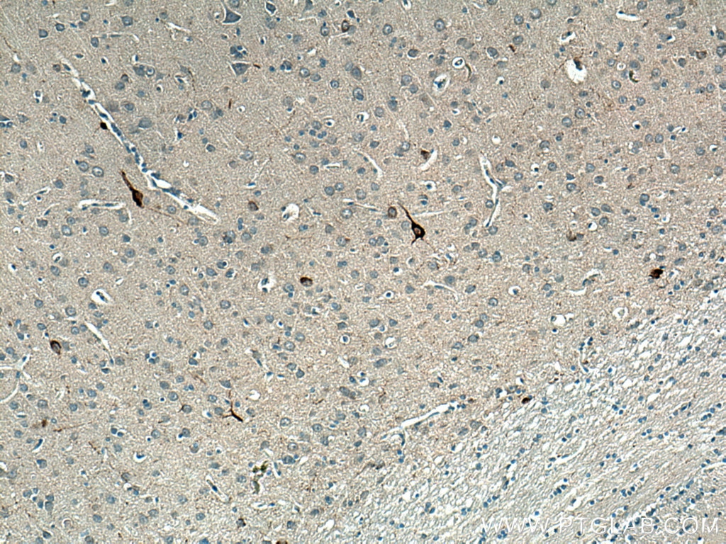 Immunohistochemistry (IHC) staining of rat brain tissue using Neuropeptide Y Polyclonal antibody (12833-1-AP)