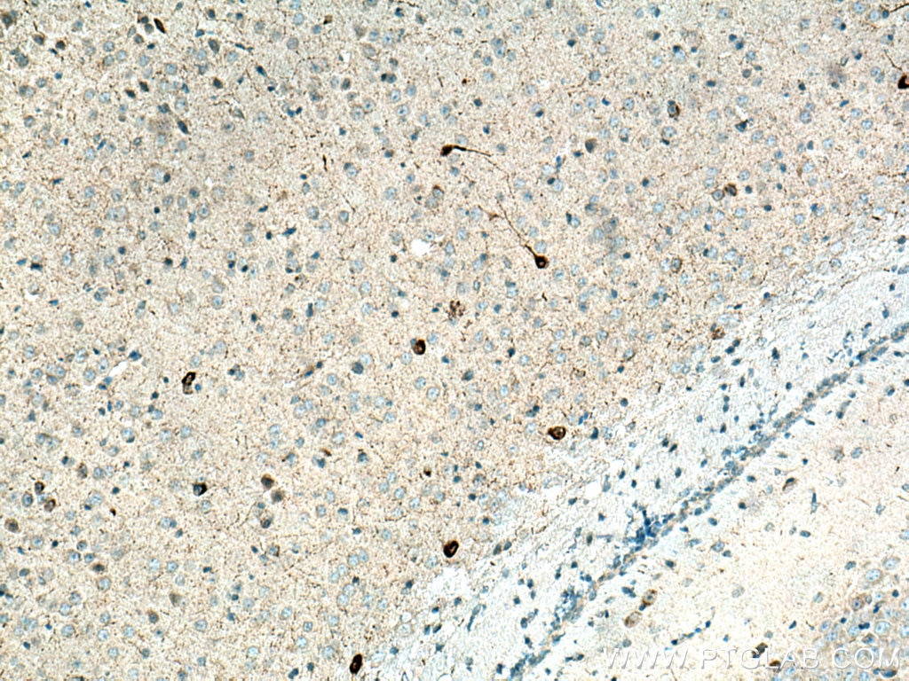 Immunohistochemistry (IHC) staining of mouse brain tissue using Neuropeptide Y Polyclonal antibody (12833-1-AP)