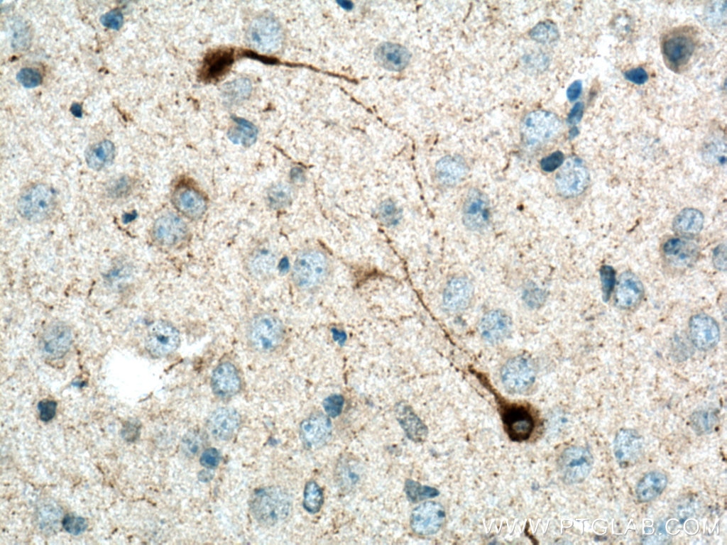 Immunohistochemistry (IHC) staining of mouse brain tissue using Neuropeptide Y Polyclonal antibody (12833-1-AP)
