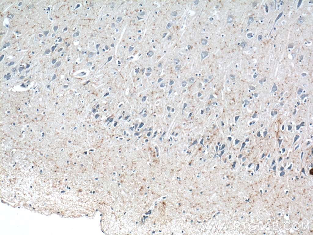 Immunohistochemistry (IHC) staining of human brain tissue using Neuropeptide Y Polyclonal antibody (12833-1-AP)