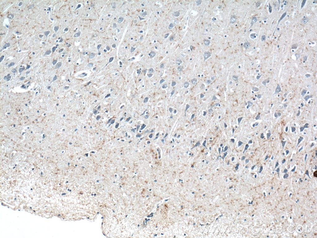 IHC staining of human brain using 12833-1-AP