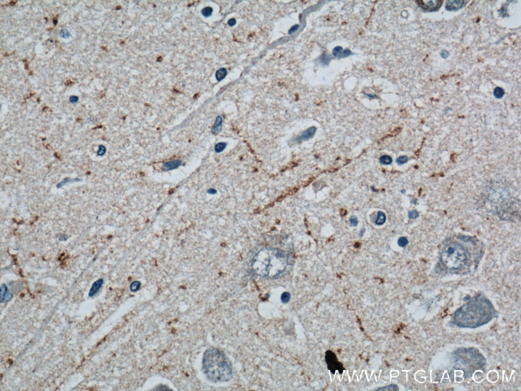 Immunohistochemistry (IHC) staining of human brain tissue using Neuropeptide Y Polyclonal antibody (12833-1-AP)