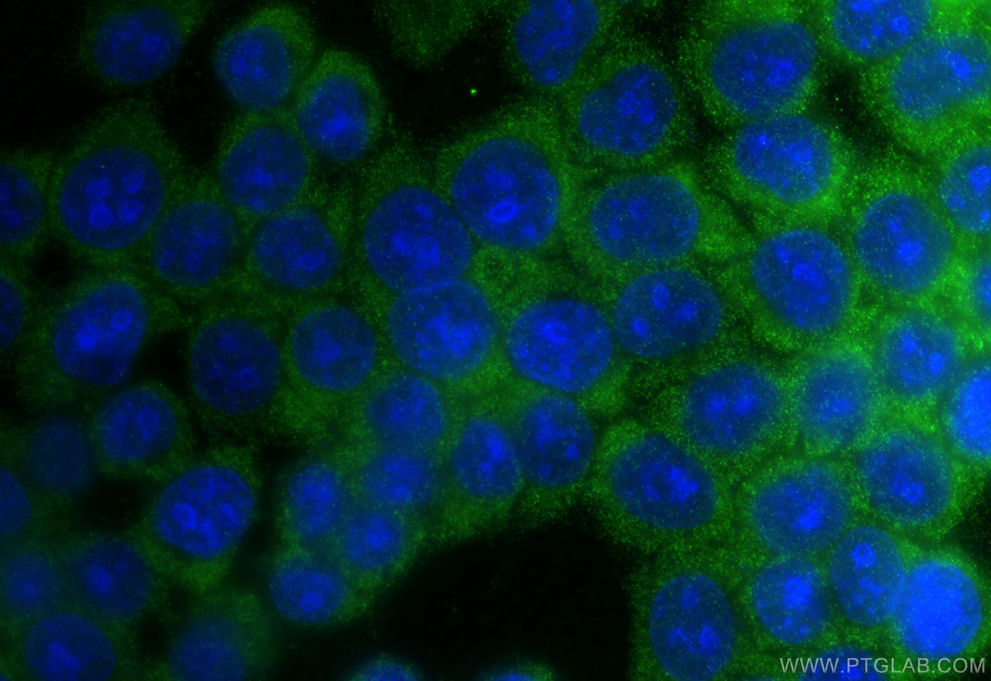 Immunofluorescence (IF) / fluorescent staining of BxPC-3 cells using NPY5R Polyclonal antibody (30848-1-AP)
