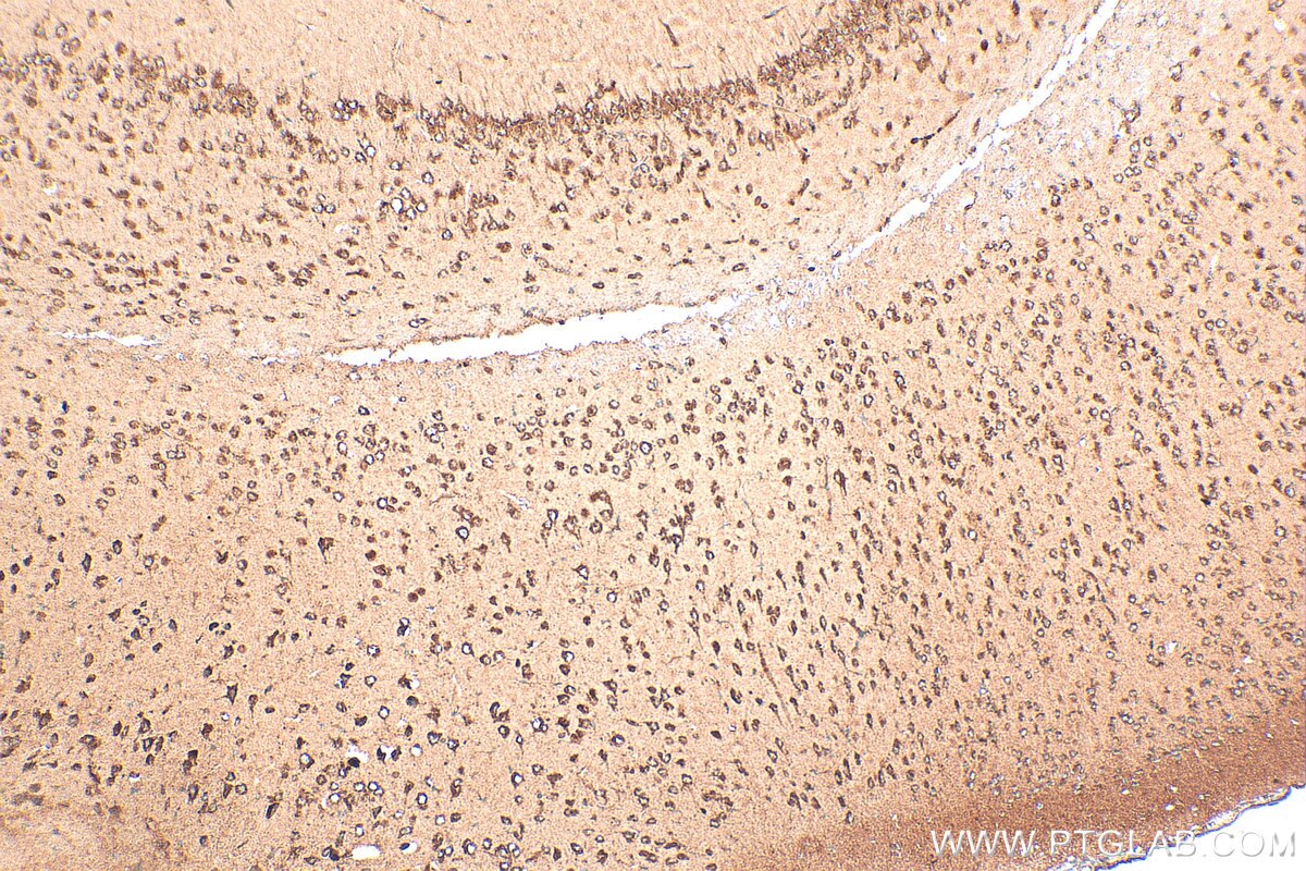Immunohistochemistry (IHC) staining of mouse brain tissue using NPY5R Polyclonal antibody (30848-1-AP)