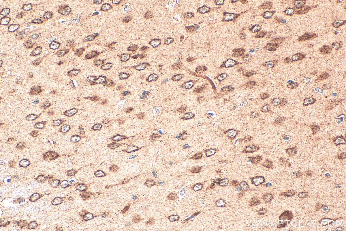 Immunohistochemistry (IHC) staining of mouse brain tissue using NPY5R Polyclonal antibody (30848-1-AP)
