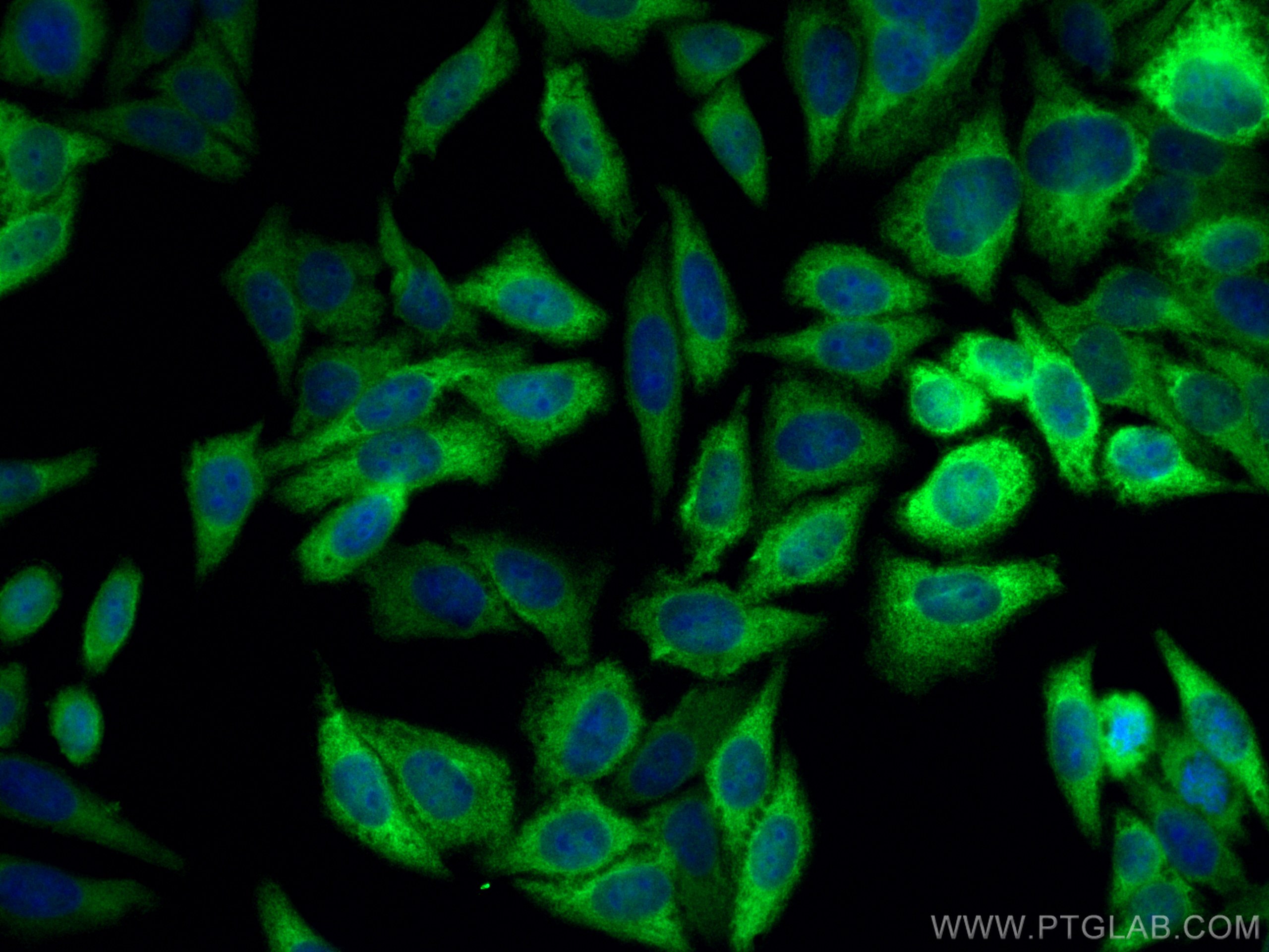 Immunofluorescence (IF) / fluorescent staining of HepG2 cells using NQO1 Polyclonal antibody (11451-1-AP)