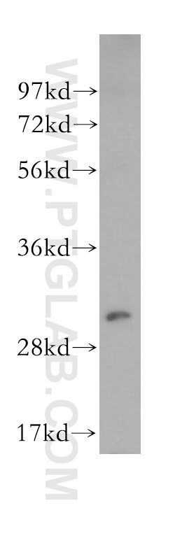 NQO1 Polyclonal antibody