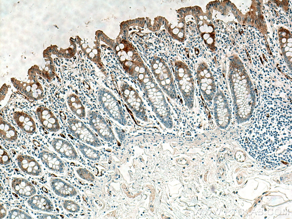 Immunohistochemistry (IHC) staining of human colon tissue using NQO1 Monoclonal antibody (67240-1-Ig)