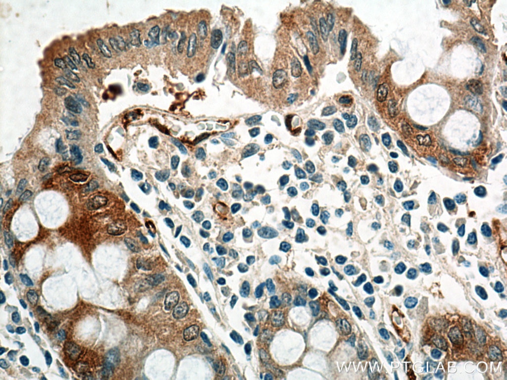 Immunohistochemistry (IHC) staining of human colon tissue using NQO1 Monoclonal antibody (67240-1-Ig)