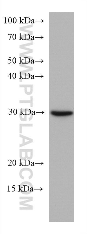 WB analysis of HepG2 using 67240-1-Ig