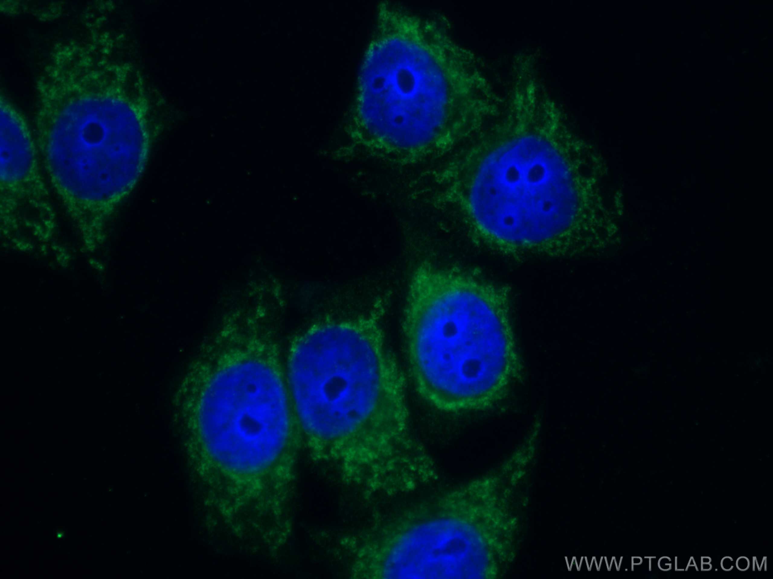Immunofluorescence (IF) / fluorescent staining of HepG2 cells using CoraLite® Plus 488-conjugated NQO1 Monoclonal anti (CL488-67240)