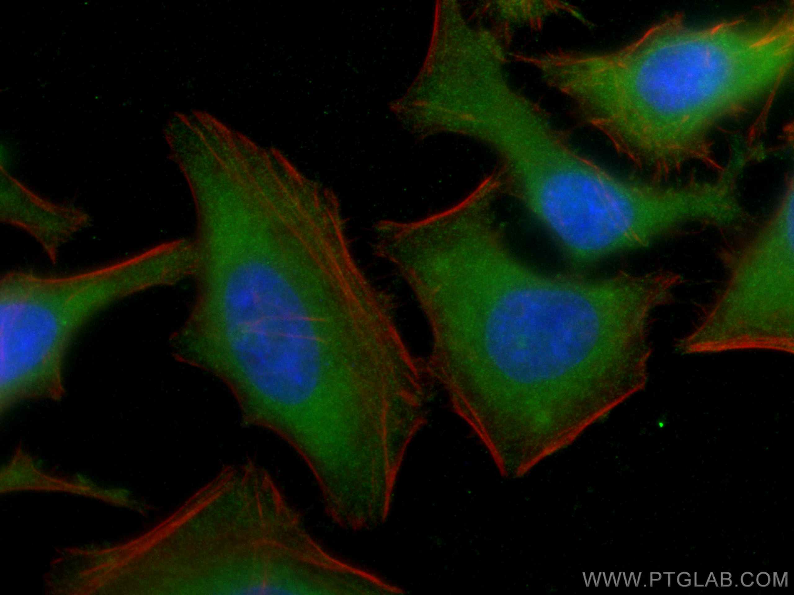 Immunofluorescence (IF) / fluorescent staining of HeLa cells using NQO2 Polyclonal antibody (15767-1-AP)
