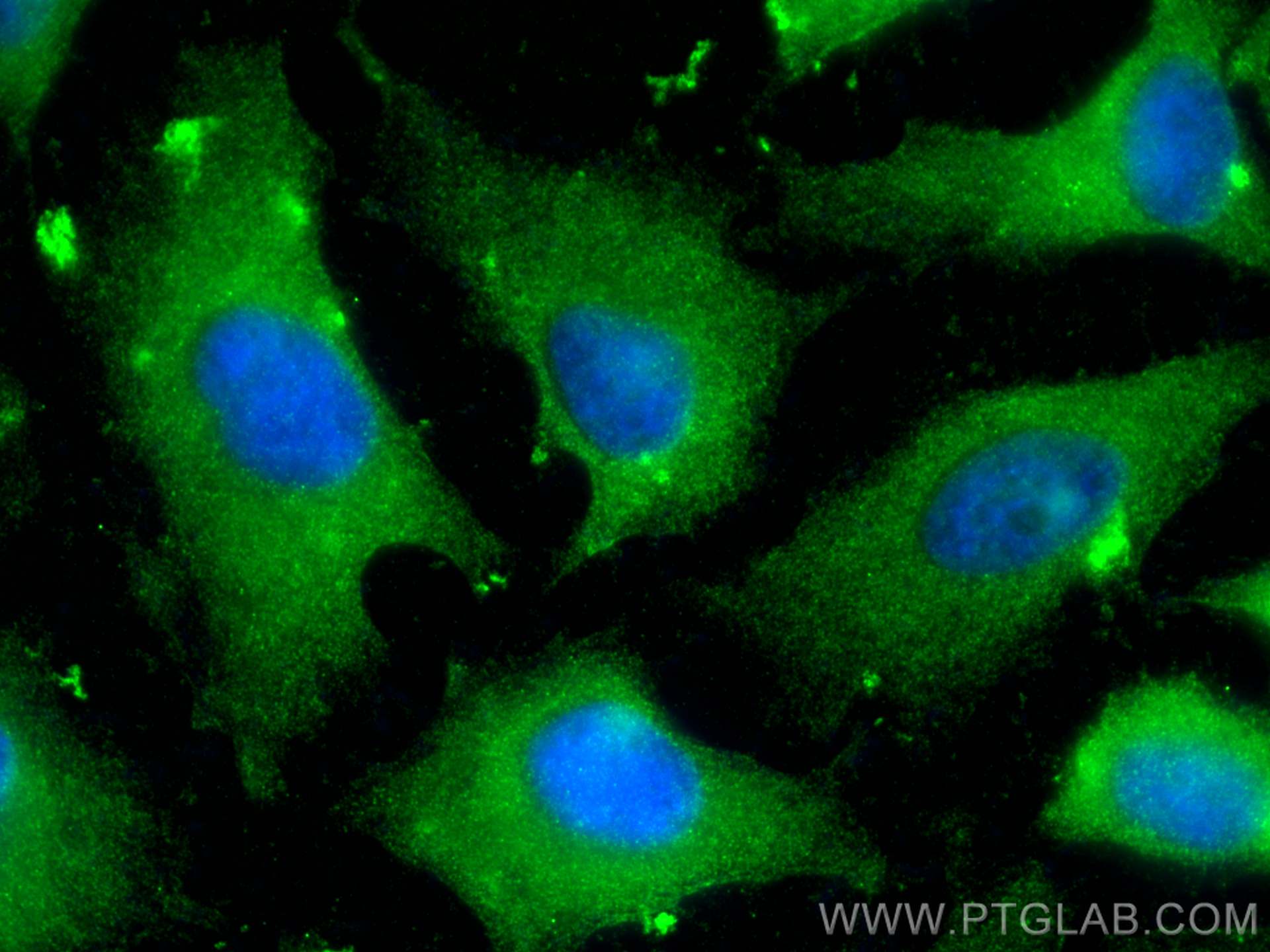 Immunofluorescence (IF) / fluorescent staining of HeLa cells using NQO2 Polyclonal antibody (15767-1-AP)