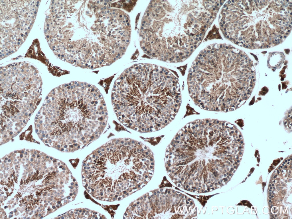 Immunohistochemistry (IHC) staining of mouse testis tissue using NQO2 Polyclonal antibody (15767-1-AP)