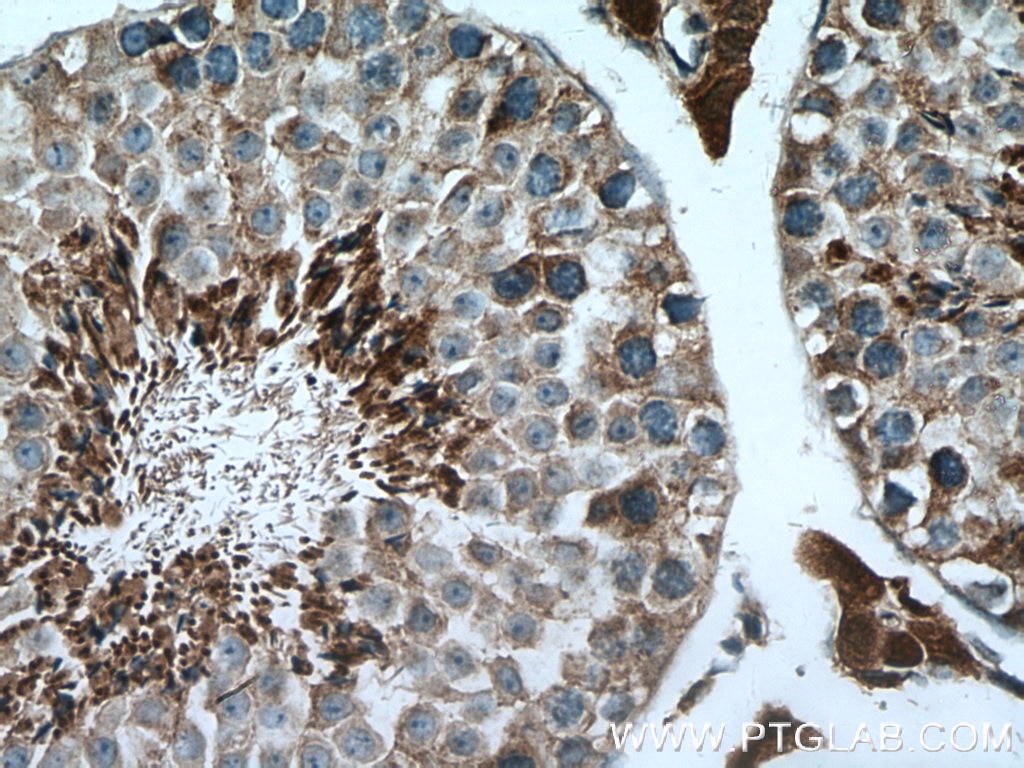 IHC staining of mouse testis using 15767-1-AP