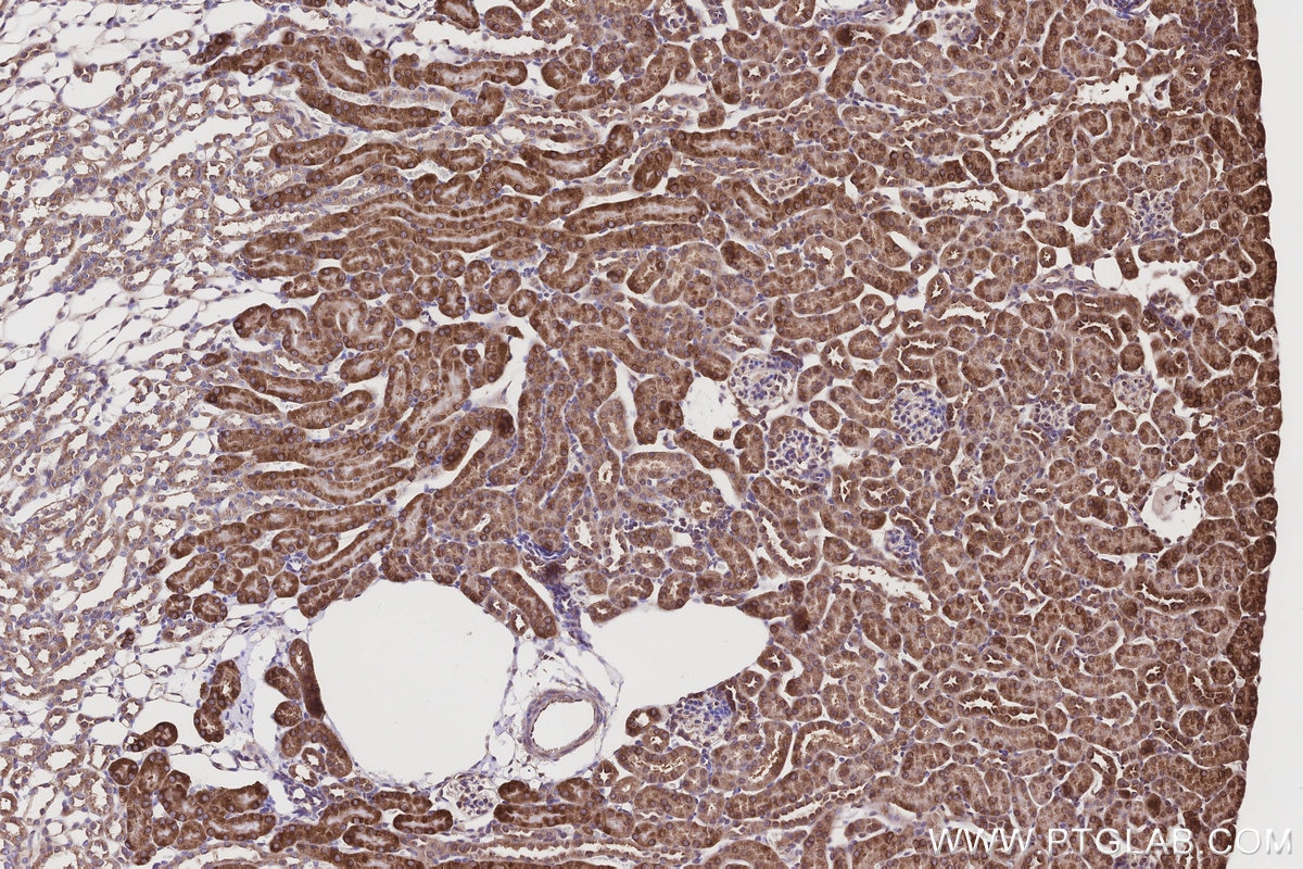 IHC staining of mouse kidney using 15767-1-AP Immunohistochemistry (IHC) staining of mouse kidney tissue using NQO2 Polyclonal antibody (15767-1-AP)