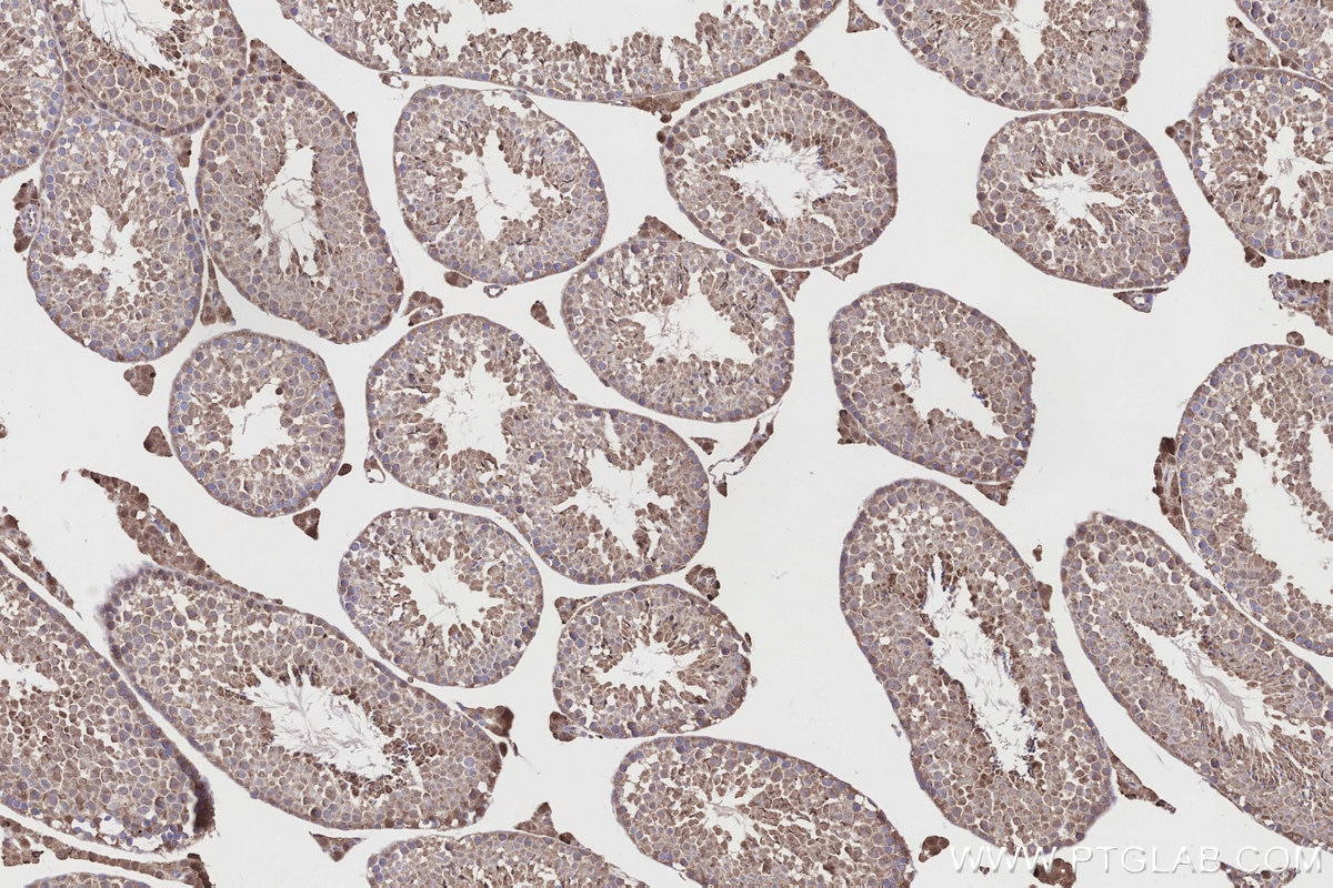 IHC staining of mouse testis using 15767-1-AP Immunohistochemistry (IHC) staining of mouse testis tissue using NQO2 Polyclonal antibody (15767-1-AP)
