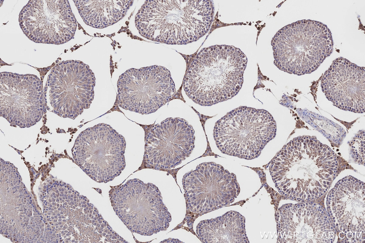IHC staining of rat testis using 15767-1-AP Immunohistochemistry (IHC) staining of rat testis tissue using NQO2 Polyclonal antibody (15767-1-AP)