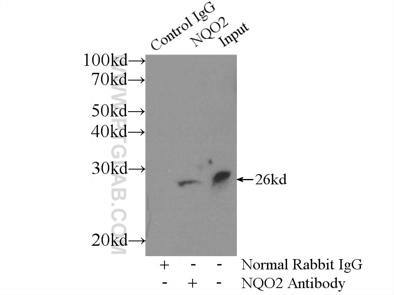 Immunoprecipitation (IP) experiment of HeLa cells using NQO2 Polyclonal antibody (15767-1-AP)