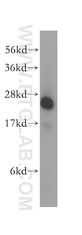 NQO2 Polyclonal antibody