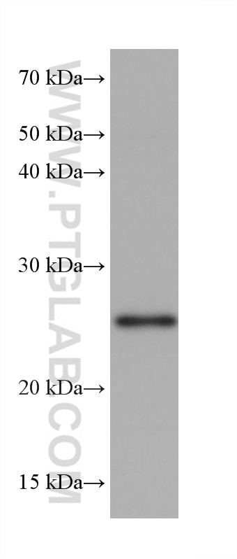 Western Blot (WB) analysis of rabbit kidney tissue using NQO2 Monoclonal antibody (68487-1-Ig)