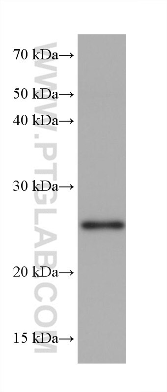 Western Blot (WB) analysis of rabbit kidney tissue using NQO2 Monoclonal antibody (68487-1-Ig)