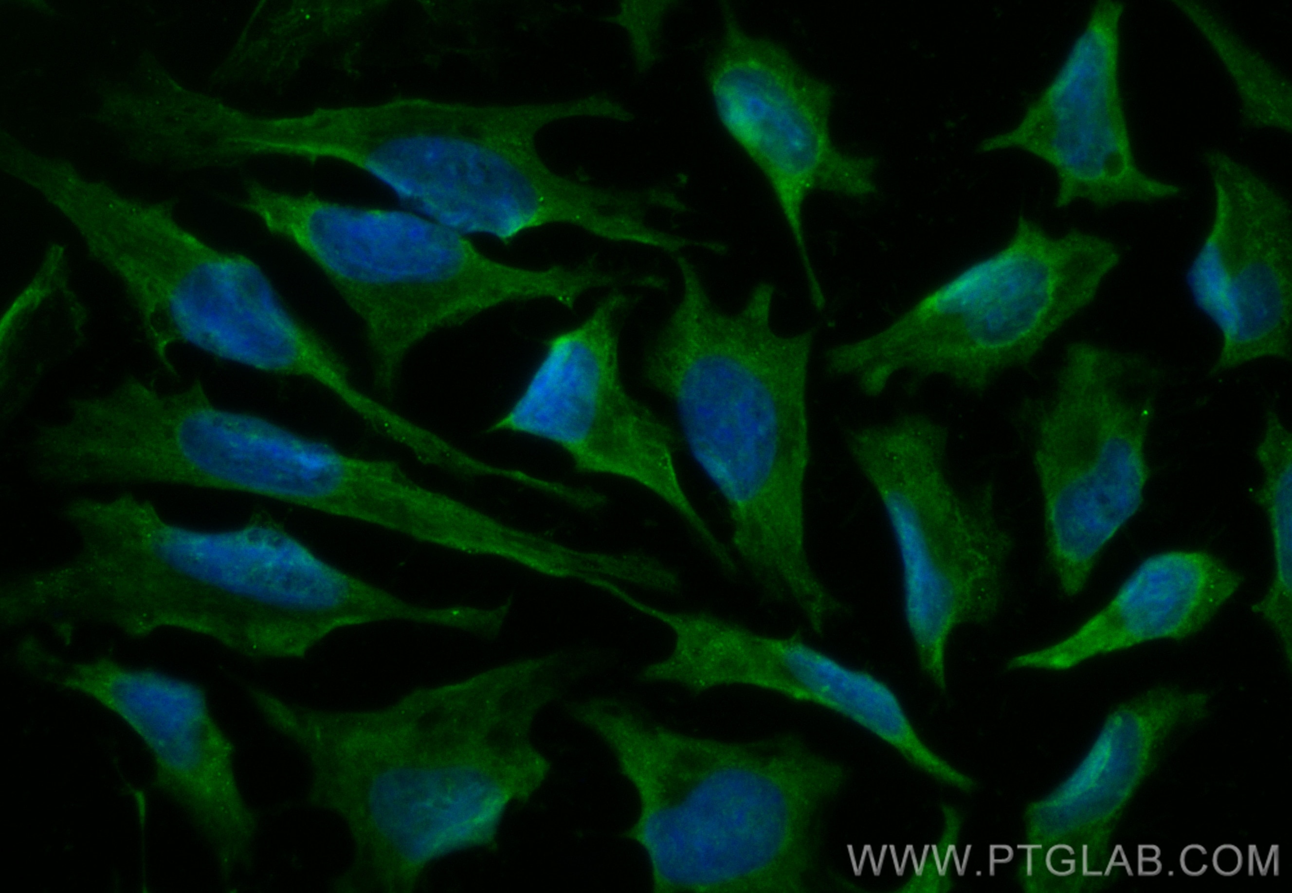 Immunofluorescence (IF) / fluorescent staining of HeLa cells using CoraLite® Plus 488-conjugated NQO2 Polyclonal anti (CL488-15767)
