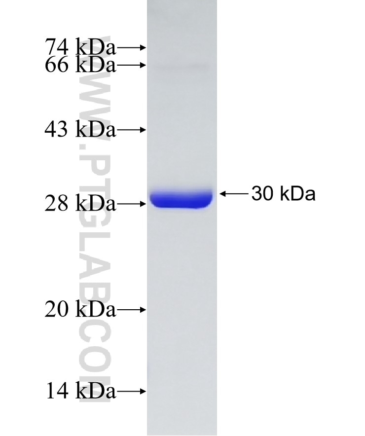 NQO2 fusion protein Ag8156 SDS-PAGE