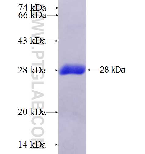 NR0B2 fusion protein Ag4411 SDS-PAGE