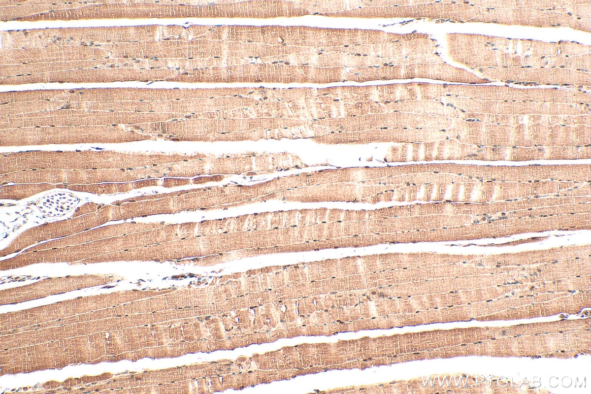 Immunohistochemistry (IHC) staining of mouse skeletal muscle tissue using NR1D1 Polyclonal antibody (14506-1-AP)