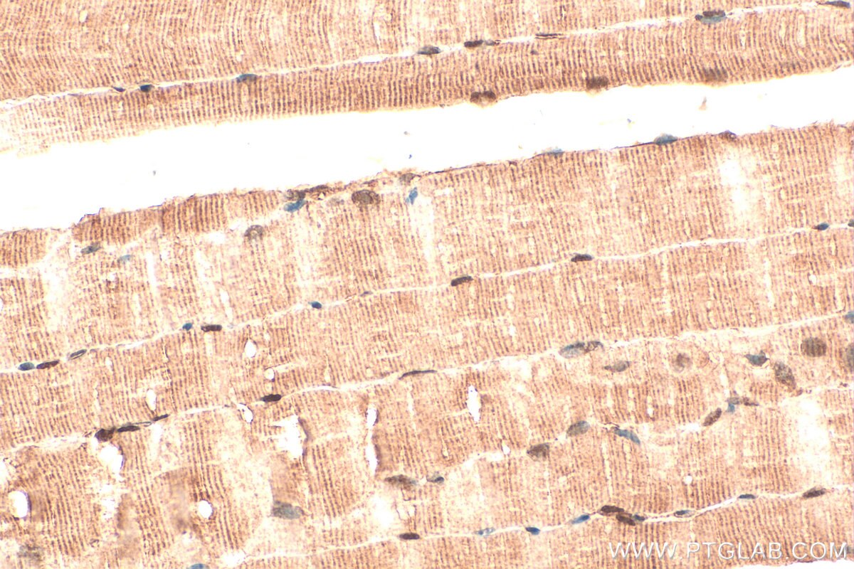 Immunohistochemistry (IHC) staining of mouse skeletal muscle tissue using NR1D1 Polyclonal antibody (14506-1-AP)