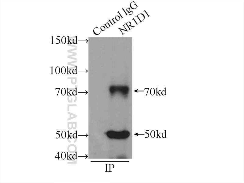 Immunoprecipitation (IP) experiment of A549 cells using NR1D1 Polyclonal antibody (14506-1-AP)