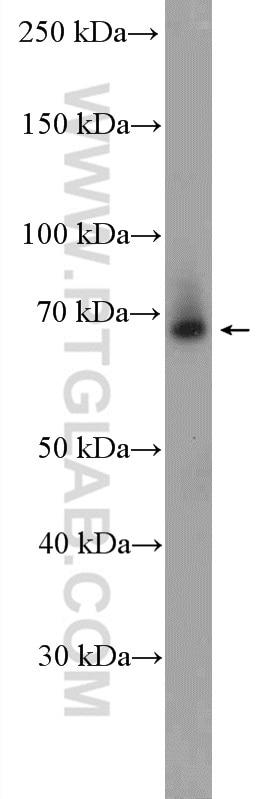 Western Blot (WB) analysis of Jurkat cells using NR1D2 Polyclonal antibody (13906-1-AP)