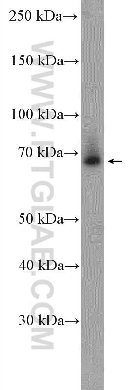 WB analysis of Jurkat using 13906-1-AP