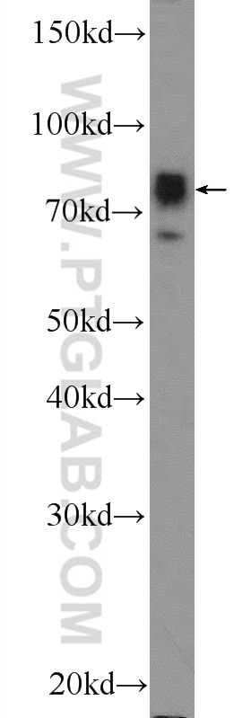 Western Blot (WB) analysis of HeLa cells using NR1D2 Polyclonal antibody (13906-1-AP)