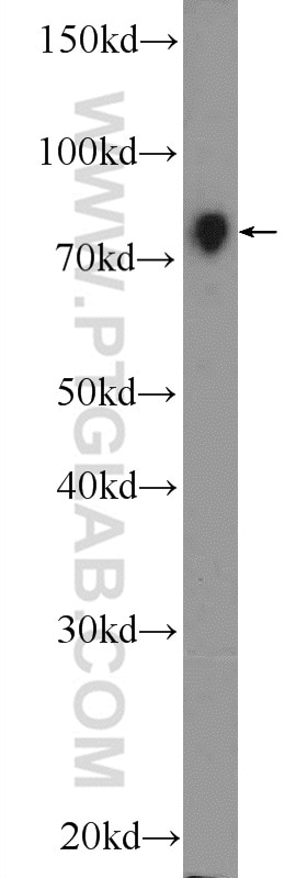 Western Blot (WB) analysis of HeLa cells using NR1D2 Polyclonal antibody (13906-1-AP)