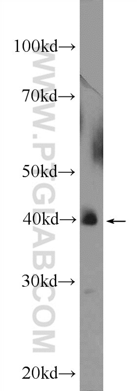 Western Blot (WB) analysis of mouse liver tissue using NR1H2 Polyclonal antibody (14278-1-AP)