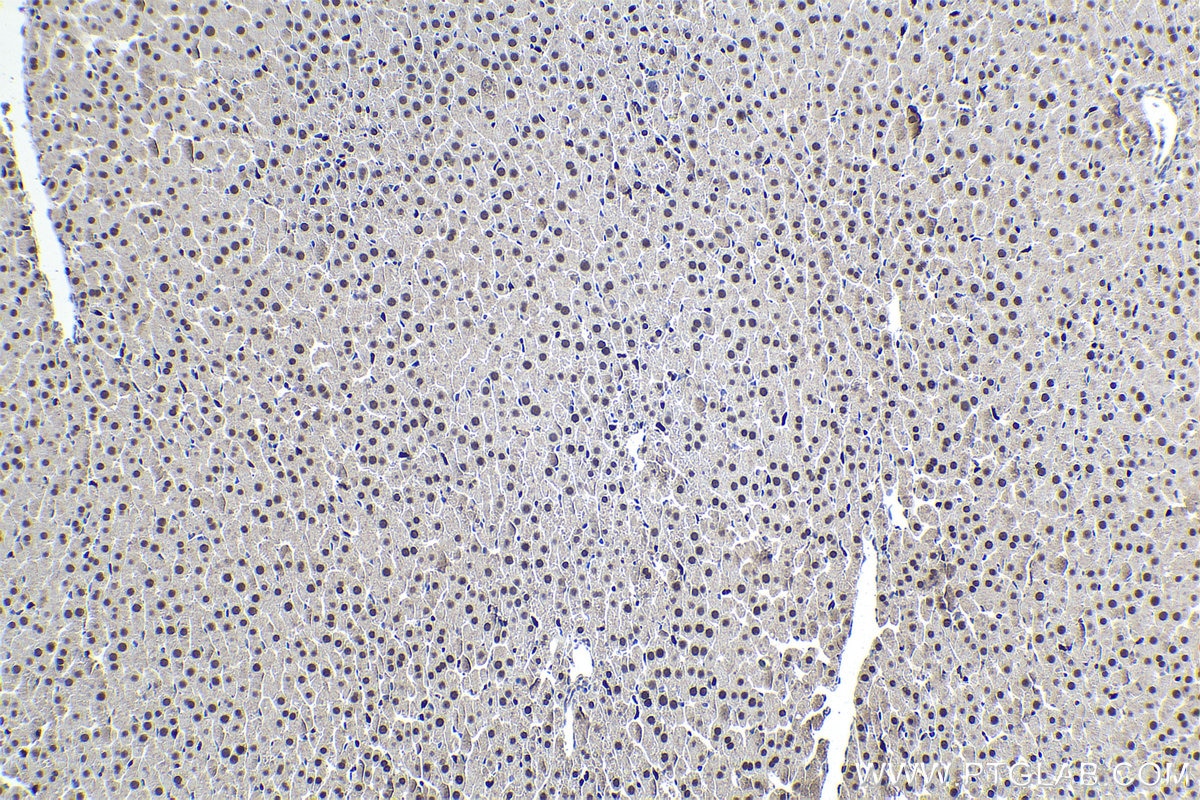 Immunohistochemistry (IHC) staining of rat liver tissue using NR1H3 Polyclonal antibody (14351-1-AP)