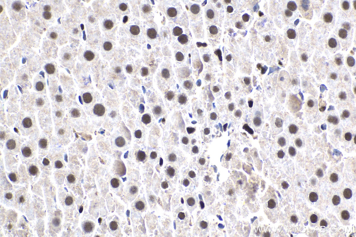 Immunohistochemistry (IHC) staining of rat liver tissue using NR1H3 Polyclonal antibody (14351-1-AP)