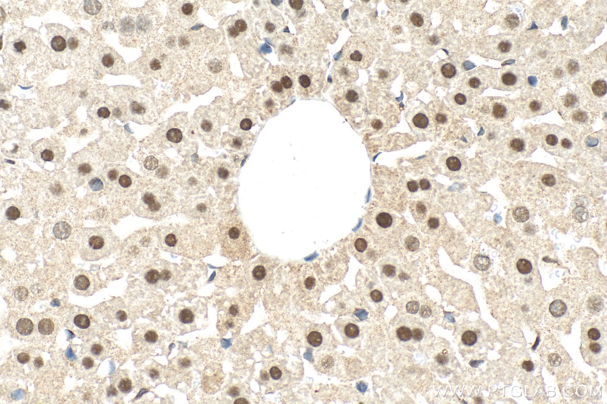 Immunohistochemistry (IHC) staining of mouse liver tissue using NR1H3 Polyclonal antibody (14351-1-AP)